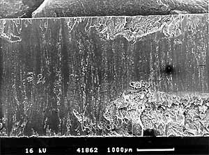 Fig.5b) Scanning electron micrograph of tensile-impact fracture surface
