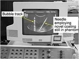 Fig.5. A comparison of an active inserted needle still in the TMM with a previous insertion point now seen as a bubble track
