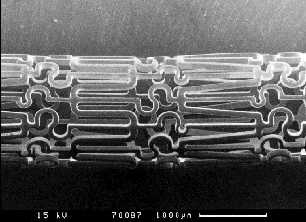 Fig 1. Photograph of stent (prior to expansion)