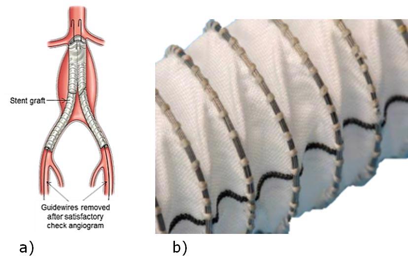 Figure 1 (a) Stent-graft; (b) NiTi wire hand-sewn to the fabric (courtesy of Vascutek and TWI Ltd)