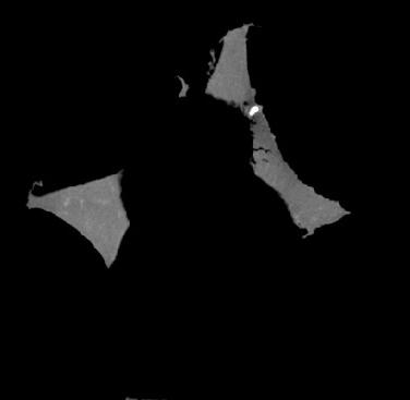 Figure 2. 2D cross-section perpendicular to the load direction of the Al open-cell foam in the undeformed condition.
