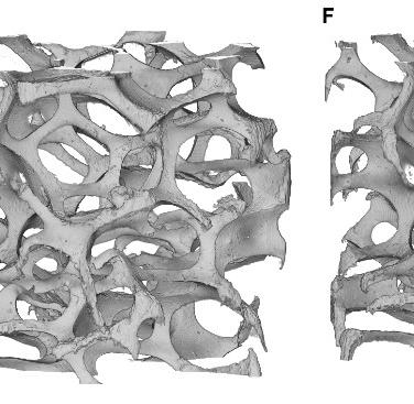 Figure 3. 3D rendering of the Al open-cell foam under compressive loading. With reference to the loading curve in Figure 1, incremental stages refer to a displacement of: 0.12 mm (A), 1.14 mm (E), 1.74 mm (F), and 2.94 mm (G). 