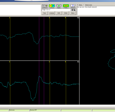 Figure 4. ACFM signal from the area with the defect.