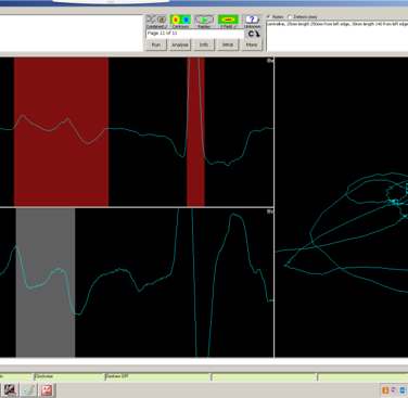 Figure 3: Data gained during the feasibility study