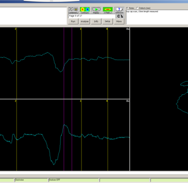 Figure 4: ACFM signal from the area with the defect