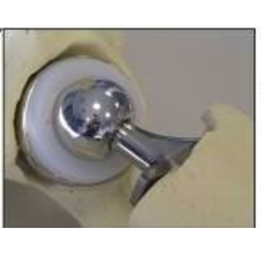 Figure 1: A prototype medical implant created using SLM during the ImplantDirect project