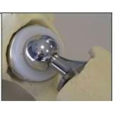 Figure 1: A prototype medical implant created using SLM during the ImplantDirect project