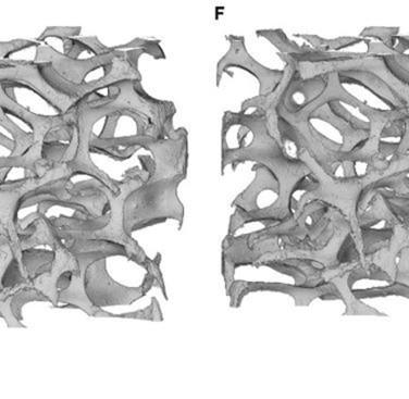 Figure 19. 3D rendering of the Al open-cell foam under compressive loading