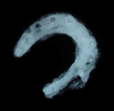 Figure 17. The x-ray clearly shows nail holes and other details