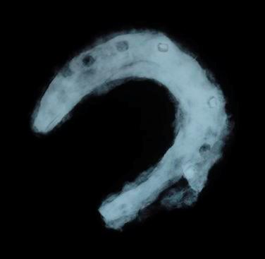 Figure 17. The x-ray clearly shows nail holes and other details