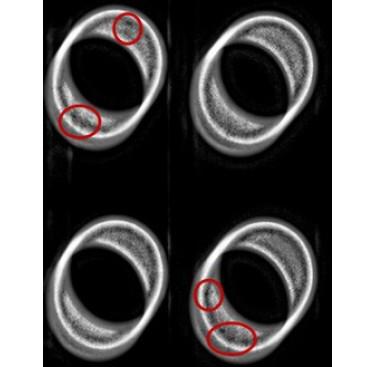 Figure 4. AutoInspect X-ray image showing porosity in PM ring samples from the automotive industry. Red circles indicate defective areas
