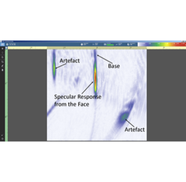 Figure 2b. VSA image of a surface breaking flaw using the self-tandem multimode method. Here the base of the flaw can be distinguished