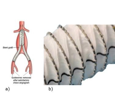 Figure 40. (a) Stent-graft; (b) NiTi wire hand-sewn to the fabric (courtesy of Vascutek and TWI Ltd)