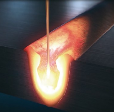 The OTC D-Arc high weld penetration system