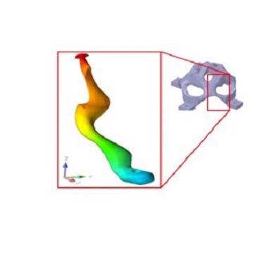 Figure 2. Casting simulation of the AM bracket