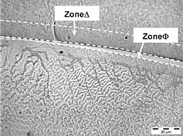 Fig.2. Micrographs of the dissimilar interface a) at mid-bead position