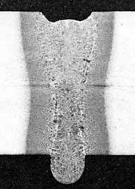 Fig. 3: Transverse cross-section of melt run in 14mm thick C-Mn steel. (Laser power 7.5kW, travel speed 0.35m/min)