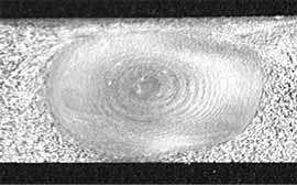 Fig.14. Macro-section through weld CD9 showing a 0.2mm high coarser grained zone in the root