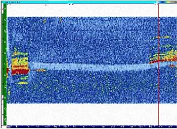 Fig.21. Plan view of GKSS demonstration weld containing lack of fusion and lack of penetration defects