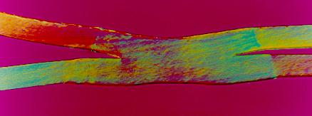 Fig.1. Lap weld in 0.1mm thick polyethylene made with a 900W CO 2 laser at 100m/min 