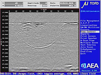 Fig.9. TOFD image of crack