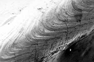 Fig.16. CW weld bead profile on electroless Ni-plated package showing solidification cracks