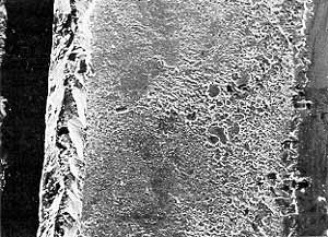 Fig.7. Joint face from electroless Ni-plated 0.25mm thick flat lid package showing complex braze structure