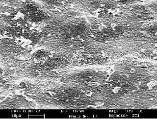 Fig.8. SEM image of fractured PMMA/acrylic joint with near-interface failure in the adhesive. The scale bar is 10µm long.