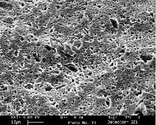 Fig.9. SEM image of fractured PMMA/acrylic joint. Opposite face to Fig.8, showing cohesive failure in acrylic adhesive. The scale bar is 10µm long.