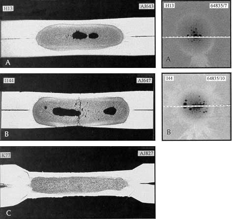 Fig.3. Metallographic sections of aluminium alloy spot welds comparing discontinuities. Radiographs show the plan view, as-welded and are marked to show the position of the subsequent section.