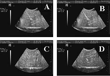 Fig. 4. Ultrasound images of sheep liver (green needles): a) Needle 149 at start of data collection; b) Needle 149 at end of data collection; c) Track left by needle 115 when removed; d) Uncoated reference needle (167) in liver
