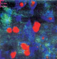 Fig.1. Confocal image of fibroblasts on 50-µm pillars with five pulses (2.5µm deep) with material topography visible from reflection microscopy. Movement of at least 30µm was identified