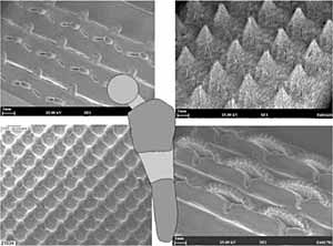 Fig.5. Potential for novel surface treatment of orthopaedic implants 