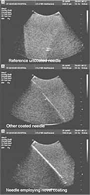 Fig.2. Echocoat comparison in TMM 