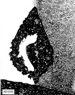 Fig.7. Pitting attack initiated at UMZ in GTA weld in S31254 steel made with ERNiCrMo-3 filler [21]