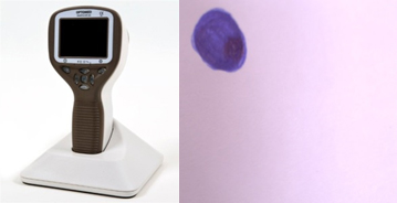 Figure 1 - Smartscope M5 device on left and input image of the study on right