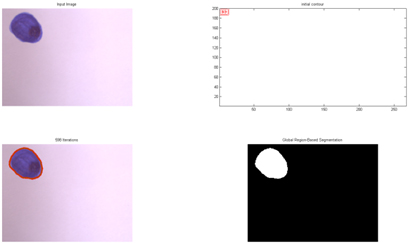 Figure 6 - Segmentation for “blue.JPG”