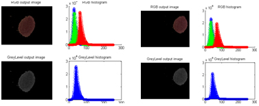 Figure 14 - Good agreements on histogram for the two methods using different images of the same skin spot which validate the colour analysis of the study 