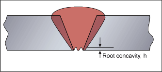 Fig.2. Root concavity 