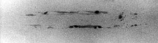 Fig. 1. Radiograph of a butt weld showing two slag lines in the weld root