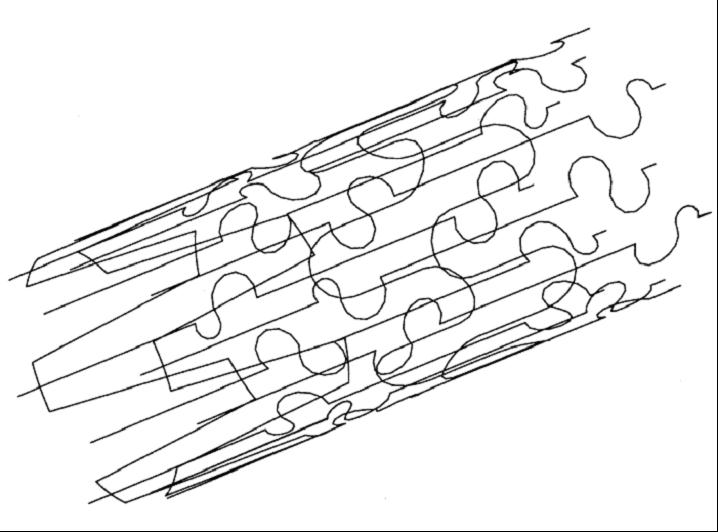 Fig 2. Finite element model of stent
