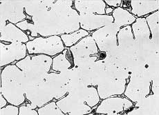 Austenite/delta ferrite (Courtesy IIW) 