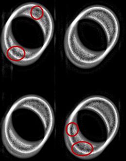 AutoInspect X-ray image showing porosity in PM ring samples from the automotive industry. Red circles indicate defective areas